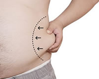 Demystifying Liposuction and Body Sculpting