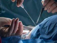 Is Top Surgery Medically Necessary?