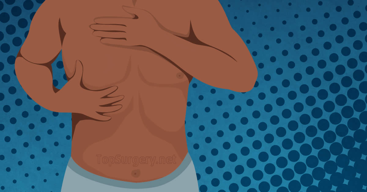 The Ultimate Primer on Top Surgery and Nipples