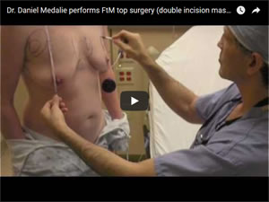 OR Video: Double Incision Top Surgery